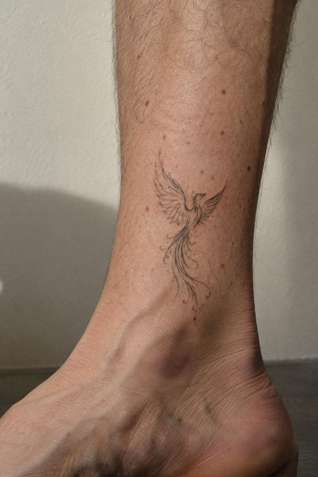 When Does Ankle Placement Make Sense?